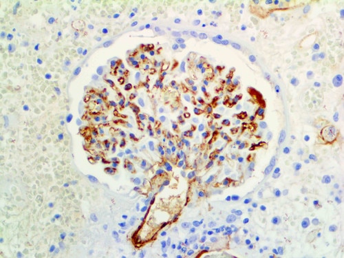 IHC of C4d on a FFPE Kidney Tissue